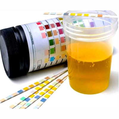 ayurvedic kidney treatment